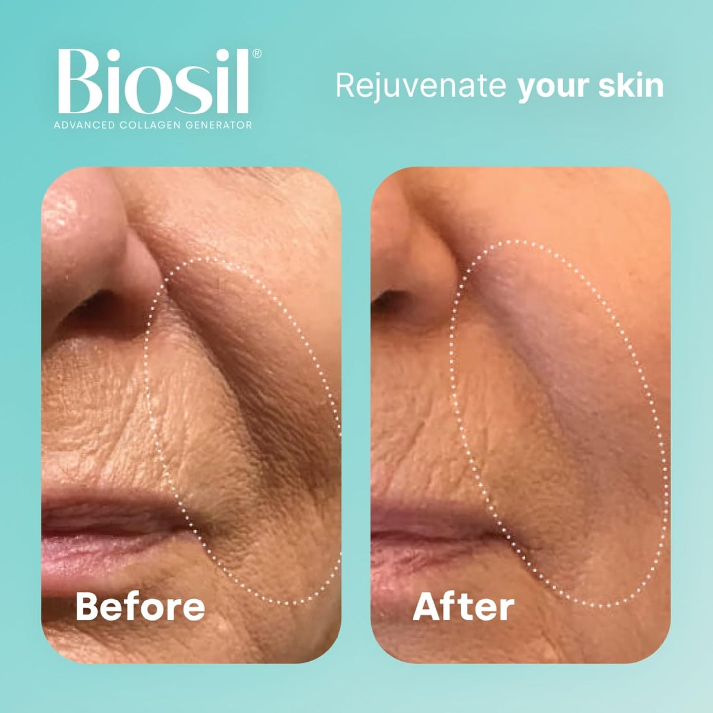 Biosil Beauty Bones Joints | Advanced Collagen Generator for Skin, Hair, Nails & Bone Support